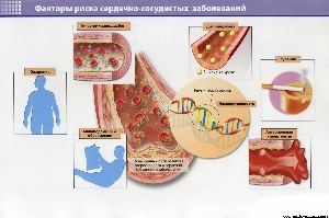 Условия работы, благоприятные для риска неудача